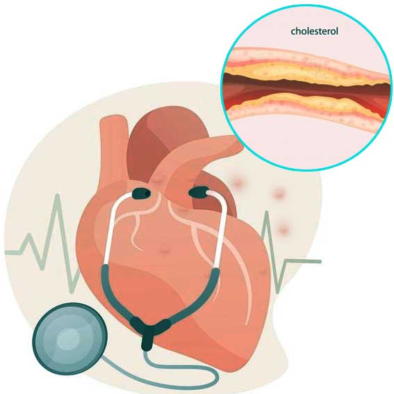 how to control cholesterol naturally