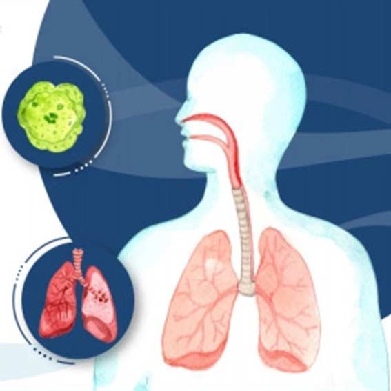 tuberculosis treatment at Unani clinic