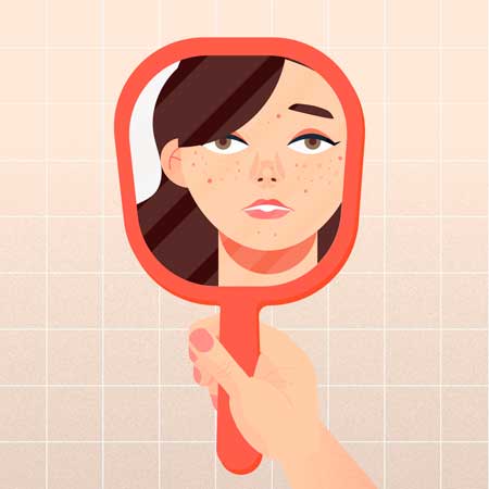 Pimple medicine for face